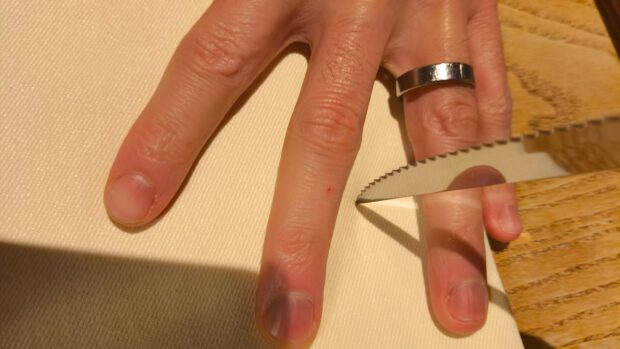 Mutprobe ohne Sepsis